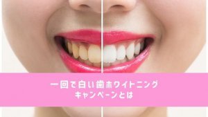 一回で白い歯ホワイトニングキャンペーン