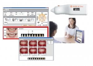 東京のホワイトニング専門歯科のコンピューターシミュレーション