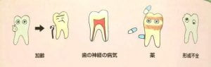 東京のホワイトニング専門歯科が教える歯の着色メカニズム２