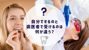 自分でするのと歯医者でするのは何が違う？