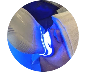 ホワイトニング光照射