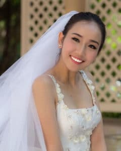 白い歯の花嫁