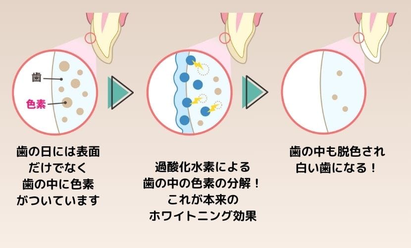 本来のホワイトニングで歯が白くなる原理