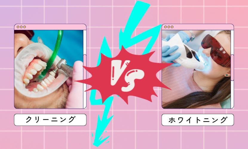 歯のクリーニングVSホワイトニング